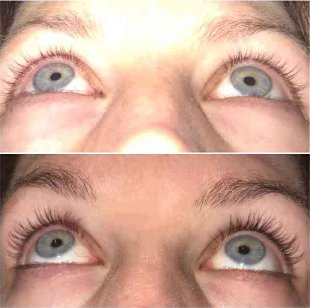 Atšķirība ir satriecoša!