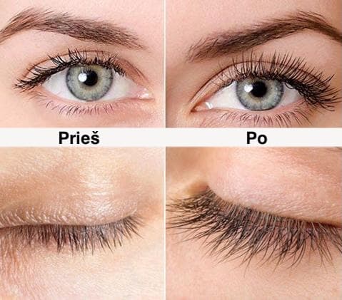 KERILASH blakstienų augimą skatinantis serumas (3 ml) 3