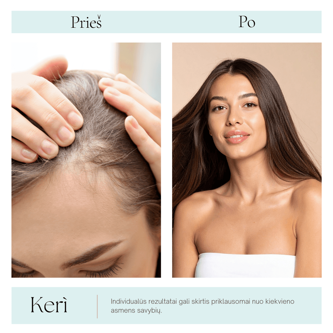 Matu augšanas aktivējošs serums 4