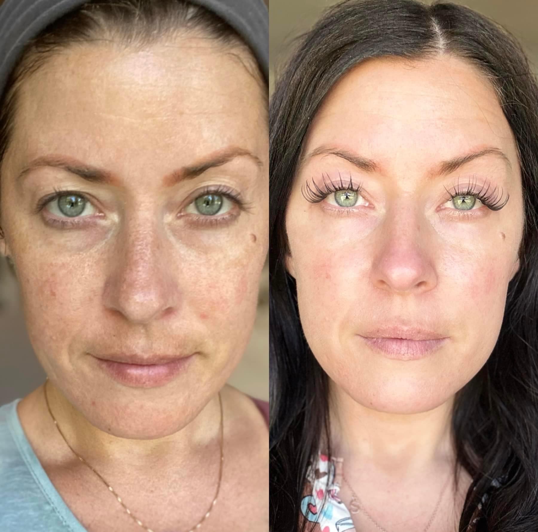 Rezultatai po 8 savaičių