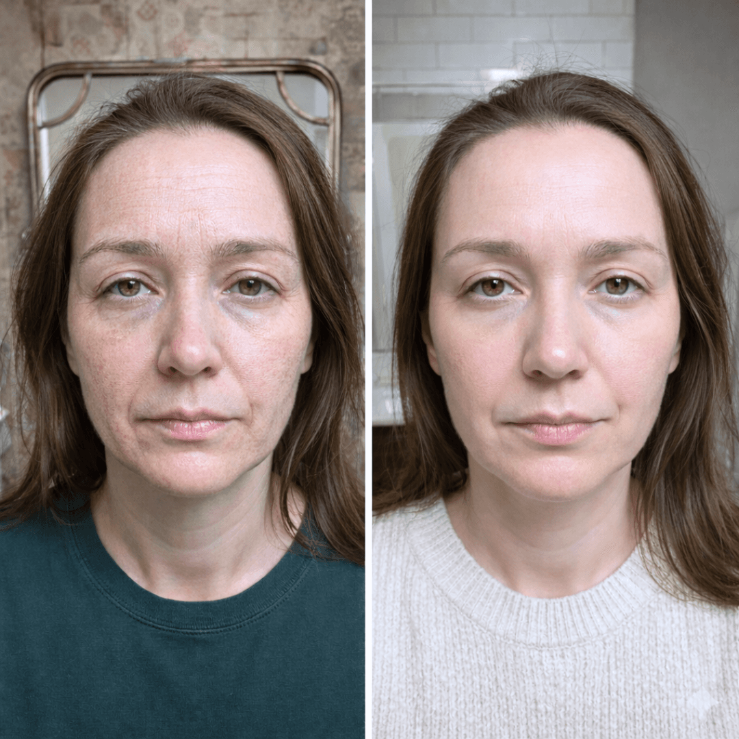 Rezultatai po 4 savaičių